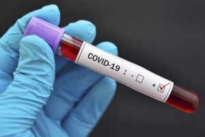 virus