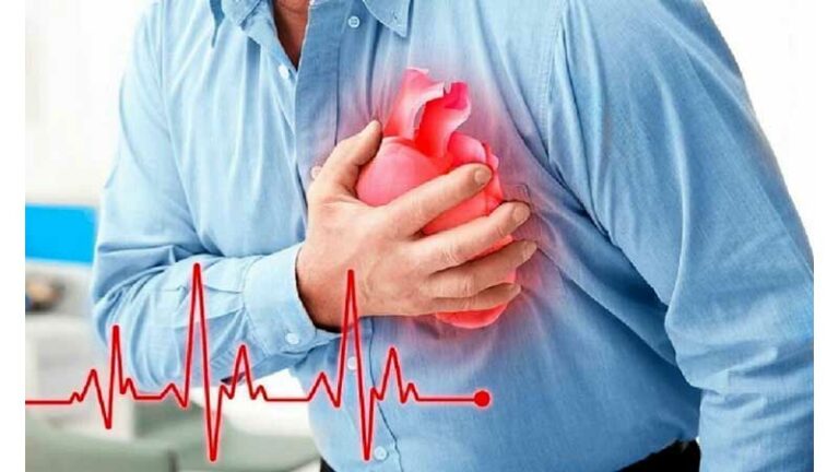 infarkt